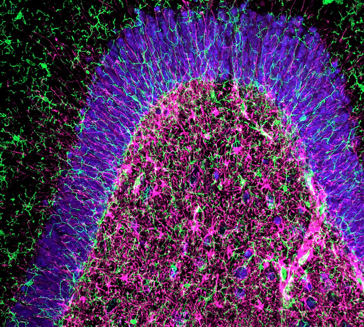 Danielle Beckman (@danibeckman) on Twitter photo Neuronal arch in the hippocampus 🤓🔬
Staining: neurons (neun, blue), microglia (iba1, green), astrocytes (gfap, magenta). <a href="/zeiss_micro/">ZEISS Microscopy</a> #neuroscience Neuronal arch in the hippocampus 🤓🔬
Staining: neurons (neun, blue), microglia (iba1, green), astrocytes (gfap, magenta). <a href="/zeiss_micro/">ZEISS Microscopy</a> #neuroscience