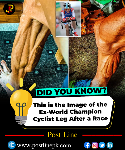 postlinepk's tweet photo. This is the Image of the Ex-World Champion Cyclist's Leg After a Race.

.
.
.
.
.
#postlinepk #postline #DidYouKnow #didyouknowfacts #DidYouKnowThis #dididididiechallenge #trending #trendingnow #race https://t.co/PihcEvbz8z