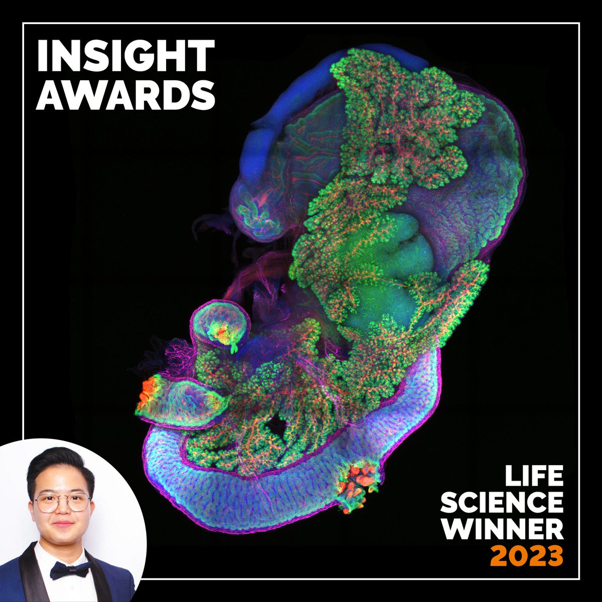 AndorTechnology's tweet photo. 📢 INSIGHT AWARDS 2023 - WINNERS ANNOUNCEMENT 📢

Life Science: Cedric Yu (@UCSF)

Physical Sciences: Carel van Gend (@SAAO)

Most public votes: Juan Antonio Moreno-Bravo (@NeuroAlc)

Congratulations 👏 https://t.co/GHPrGeJxPB