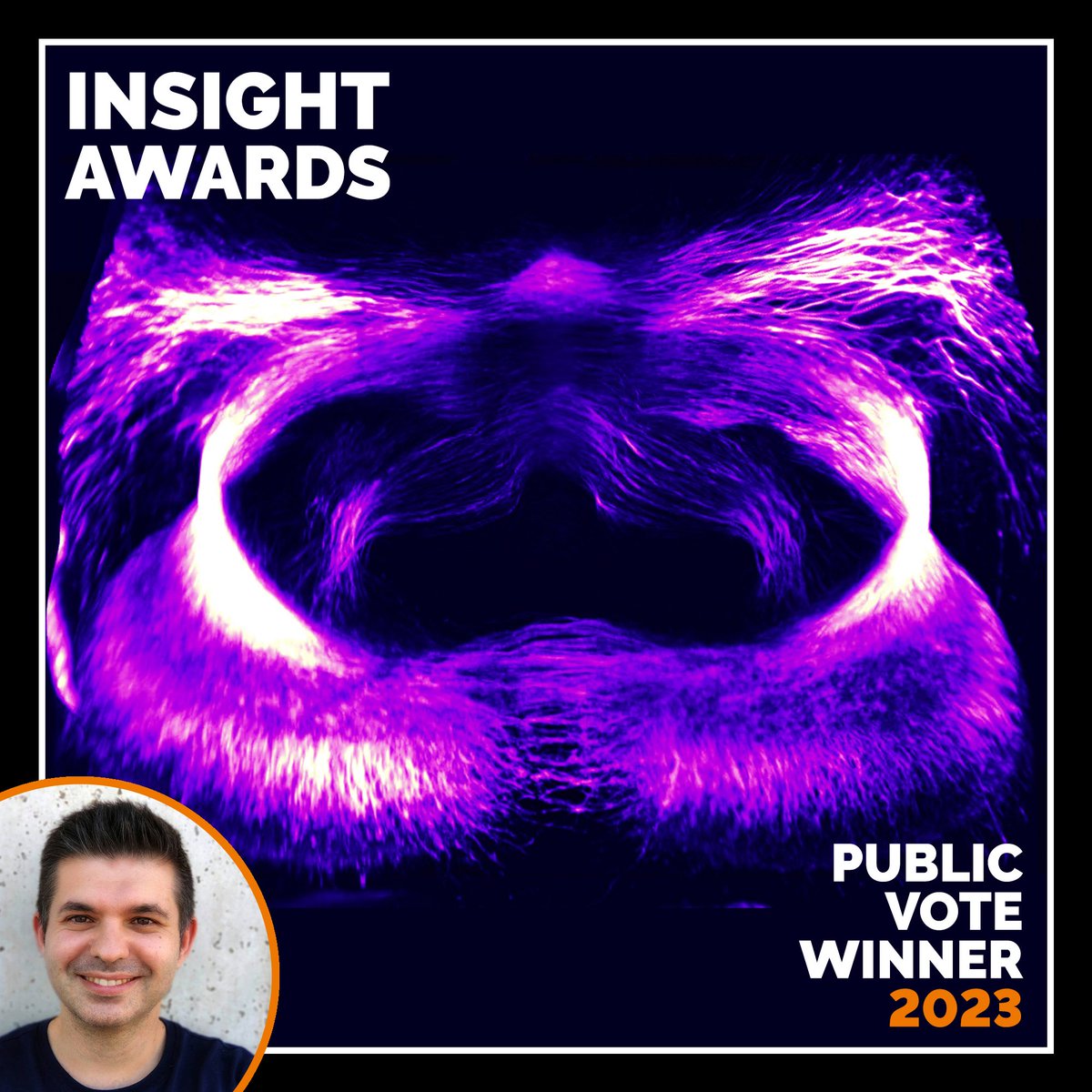 AndorTechnology's tweet photo. 📢 INSIGHT AWARDS 2023 - WINNERS ANNOUNCEMENT 📢

Life Science: Cedric Yu (@UCSF)

Physical Sciences: Carel van Gend (@SAAO)

Most public votes: Juan Antonio Moreno-Bravo (@NeuroAlc)

Congratulations 👏 https://t.co/GHPrGeJxPB