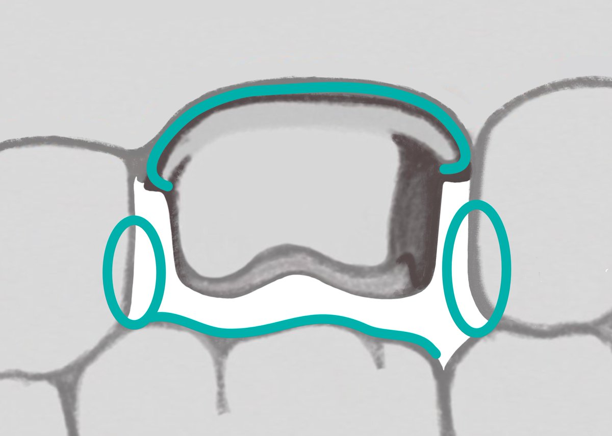 ddldental's tweet photo. When scanning critical aspects of a case, capture the contact and occlusal aspects that need to be in contact with the restoration(s).

https://t.co/EqLEy4Kyz2

#digitaldentistry https://t.co/e45CaRtto3