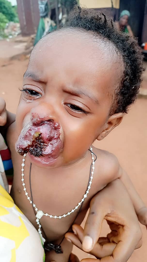 mcsharpbaby's tweet photo. Good evening my people please I need your assistance 
My name is Ogekhomhe Shedrack 
I am from Iviukhua   
My baby needs to undergo an operation to remove to bump 
~OGEKHOMHE SHEDRACK
07016634597.. dm me on wasap 08122760448 for clear details.. Nigerians pls help. https://t.co/lFewAHgGeh