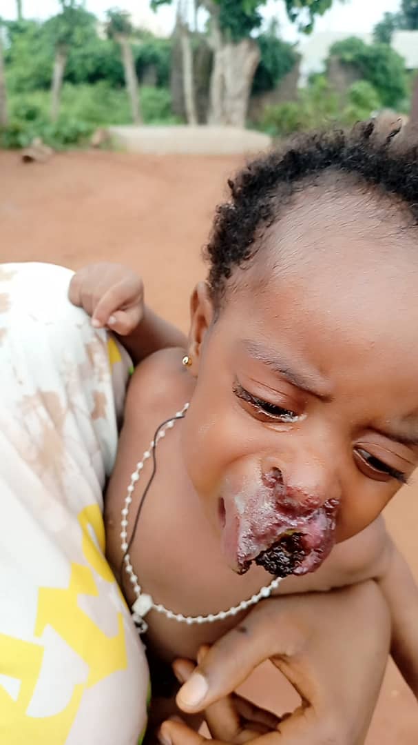 mcsharpbaby's tweet photo. Good evening my people please I need your assistance 
My name is Ogekhomhe Shedrack 
I am from Iviukhua   
My baby needs to undergo an operation to remove to bump 
~OGEKHOMHE SHEDRACK
07016634597.. dm me on wasap 08122760448 for clear details.. Nigerians pls help. https://t.co/lFewAHgGeh
