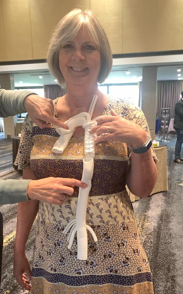 AorticDissectUK's tweet photo. One of our founder members @cottonclan visited the @TerumoAortic stand at the Barts #Aortovascular Symposium #BAVS900 & was shown how her dissected #Aorta was totally replaced in 3 operations using the company’s products. Thank you @Derriford_Hosp @uhbtrust @jgmascaro59 #AortaEd https://t.co/ZApocOCG56