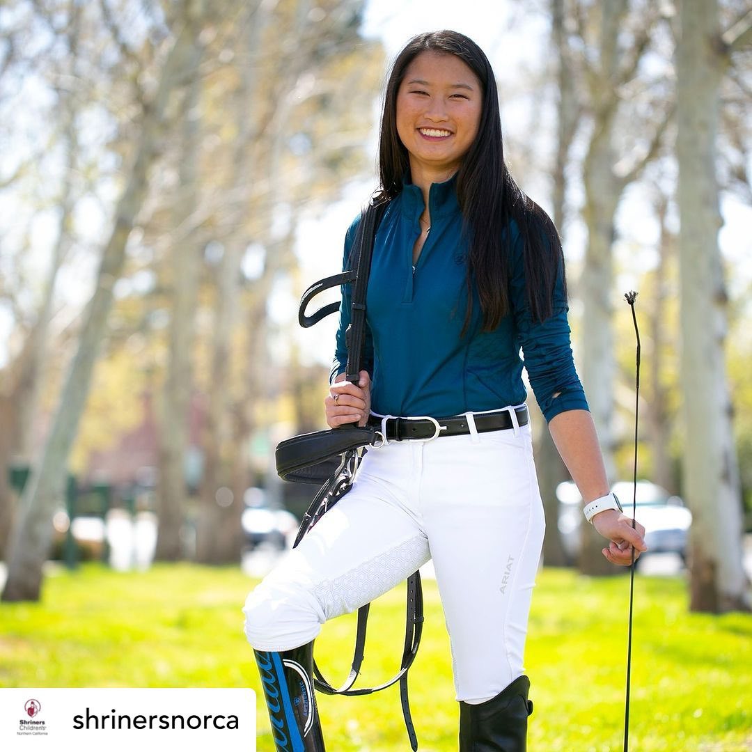 shrinershosp's tweet photo. Andie Sue and Kaysie Li are sisters who were both born with congenital limb deficiencies that required leg amputations. Over the years, @ShrinersNorCA  and the POPS team have given these girls the ability to live their best lives. 
#prosthetics  #shrinerschildrens https://t.co/O0frLqZR7x