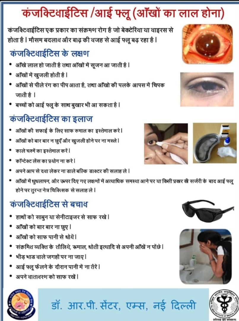 #conjunctivitis #EyeFlu मानसून के दौरान अपनी आंखों का विशेष ध्यान रखें, कंजंक्टिवाइटिस (आई फ्लू) से बचें। @ParulAggarwal04 @thesks24 @PrashantSahyog @Samaachaar_r @PoojaThakur2907 @Shivani15691817 @PrernaSrivasta @AskRoushan @KarunDrishti @HopefulShelter