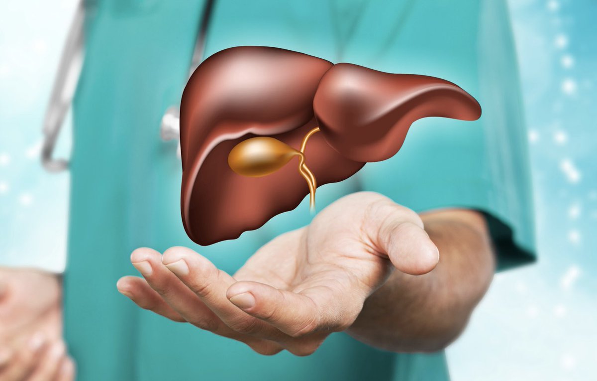 Liver transplant for colorectal cancer mets 😱 long term results from 🇳🇴 

🧍‍♂️61 pts with non resectable CRLM in 14 years 

👍 Predictor of outcomes were tumor size, CEA, number of lesions 

🔟 year survival of 90% for Oslo score 0

🏔️ A new milestone ?!

jamanetwork.com/journals/jamas…