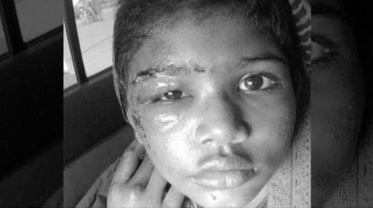 Bushra_Saqib6's tweet photo. It's disheartening that such incidents continue to occur despite past cases like Tayyaba. #JusticeForRizwana #BanChildDomesticLabour. @CRMPak, your efforts in advocating for children's rights are commendable, and together, we can work towards a safer environment for all children. https://t.co/6FuMfUp0Sz