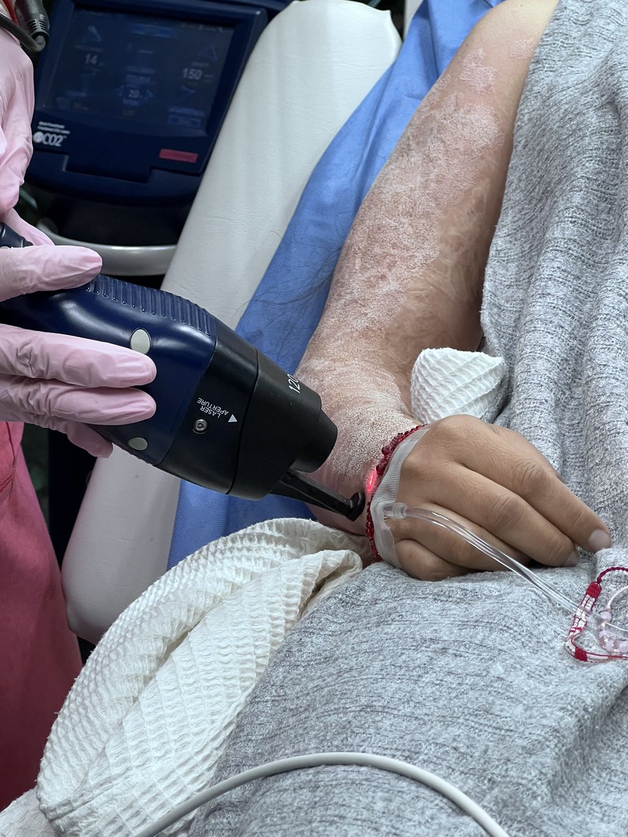 _ElenaRios's tweet photo. Hoy tuve tratamiento dermatológico con la doctora Isela Méndez ♥️.

Los tratamientos con láser son muy dolorosos, costosos y de años para seguirme recuperando. Es una parte de la rehabilitación cuando intentan matarte con #ácido. 

‼️Seguiré de pie‼️
#NoMásÁcido 
#SeráLey 
💜🎷 https://t.co/3SLOnML4h3