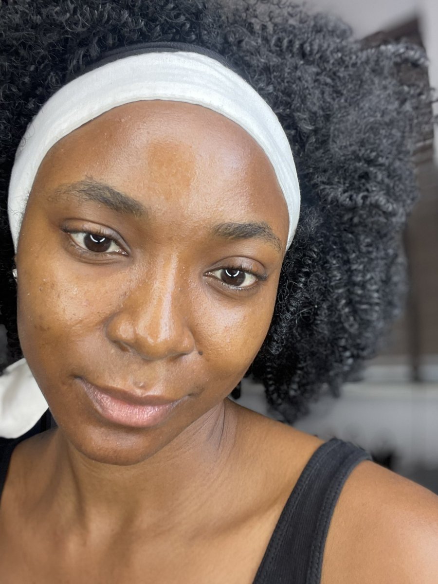 im_perpetual's tweet photo. I always had tiny rashes and itches on my face, I didn’t know my face was lacking moisture and hydration. But when I started using this @OriflameNigeria Optimals even out routine. I started seeing my face glow in the most healthy way ever! #BBNaijaXOriflame #MyFaveOriflame https://t.co/pIZeOaBlEJ