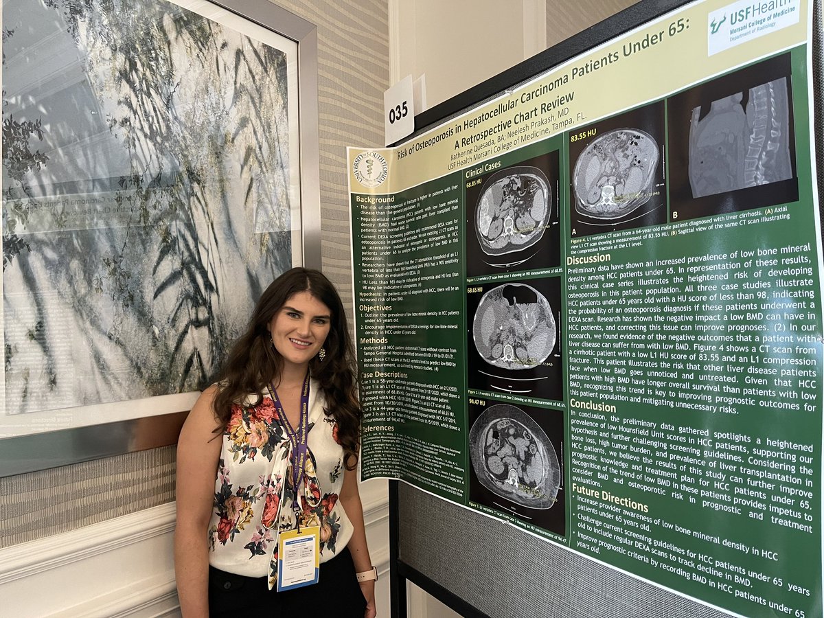 Krishna Nallamshetty, MD, FACR (@knallammd) on Twitter photo So proud of our <a href="/usfradiology/">USF Radiology - Residency & Fellowship</a> residents and medical students who presented 18 posters at the FL <a href="/RadiologyACR/">American College of Radiology</a> annual meeting this month! (4 of 4 posts)
<a href="/USFHealth/">USF Health</a> #tghcares #medtwitter
#frs2023 #radres #radiology #usfradiology #radleader #usfhealth #futureradres #radfellow So proud of our <a href="/usfradiology/">USF Radiology - Residency & Fellowship</a> residents and medical students who presented 18 posters at the FL <a href="/RadiologyACR/">American College of Radiology</a> annual meeting this month! (4 of 4 posts)
<a href="/USFHealth/">USF Health</a> #tghcares #medtwitter
#frs2023 #radres #radiology #usfradiology #radleader #usfhealth #futureradres #radfellow