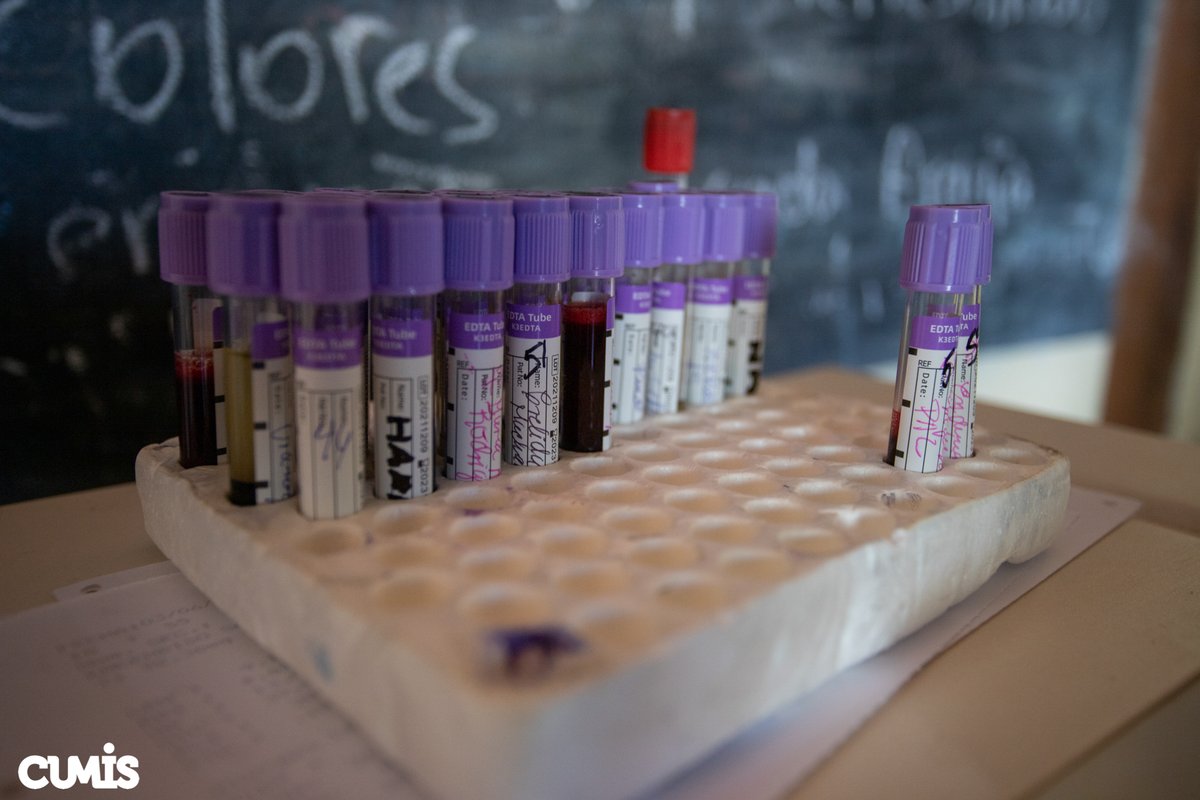 cumisucv's tweet photo. ¡Bioanálisis en la Guajira! .Gracias a esta especialidad logramos el  diagnóstico y seguimiento de enfermedades. Se realizaron exámenes hematológicos, urológicos, bacteriológicos y parasitológicos a solicitud del especialistas🦠. https://t.co/nDw5AhAng4