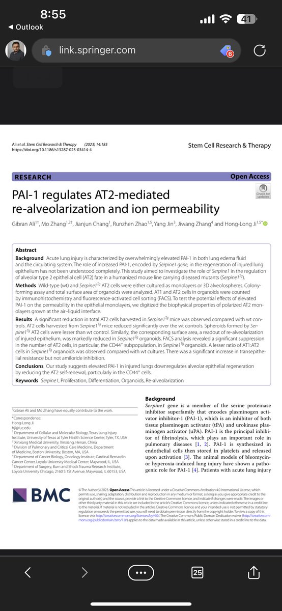 Gibran Ali (@gibrana03387565) on Twitter photo Recent publication of our series of work on role fibrinolytic niche in alveologenesis Recent publication of our series of work on role fibrinolytic niche in alveologenesis