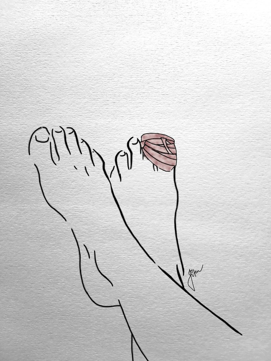 JitendraGhorela's tweet photo. 𝐎𝐮𝐜𝐡! 𝐎𝐧𝐞 𝐬𝐭𝐞𝐩 𝐚𝐭 𝐚 𝐭𝐢𝐦𝐞.🦶🏻 
𝙿𝚂: 𝚆𝚑𝚎𝚗 𝚢𝚘𝚞'𝚛𝚎 𝚒𝚗𝚓𝚞𝚛𝚎𝚍, 𝚛𝚎𝚖𝚎𝚖𝚋𝚎𝚛 𝚝𝚘 𝚝𝚊𝚔𝚎 𝚝𝚑𝚎 𝚝𝚒𝚖𝚎 𝚝𝚘 𝚕𝚎𝚊𝚗 𝚒𝚗𝚝𝚘 𝚢𝚘𝚞𝚛 𝚌𝚛𝚎𝚊𝚝𝚒𝚟𝚎 𝚜𝚒𝚍𝚎. https://t.co/I0WpI8Tnuz