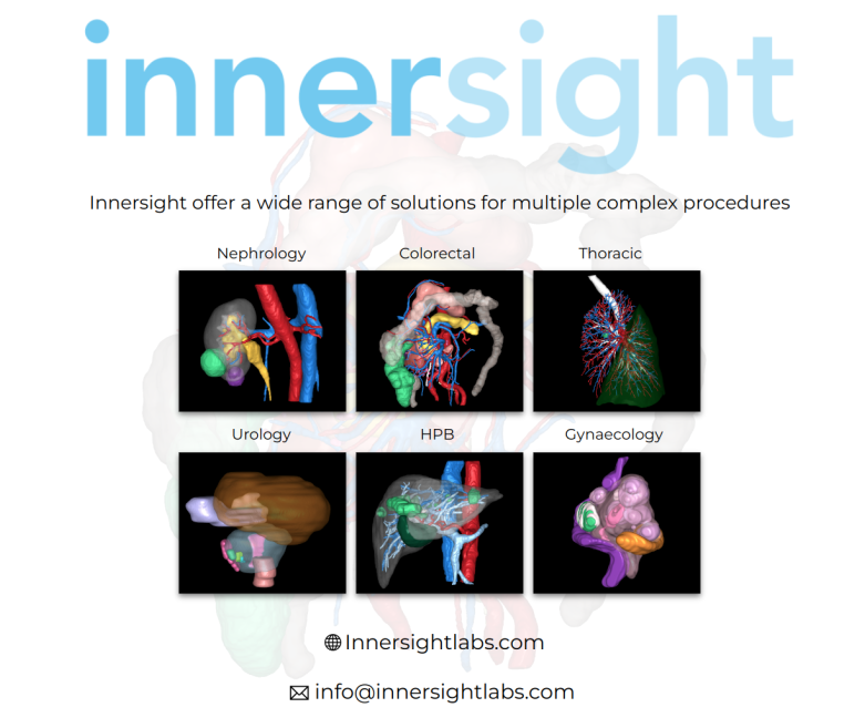 innersightlabs's tweet photo. Explore the benefits of patient-specific #3Dmodels for surgical planning and navigation.
Lower risk of complications, shorter procedures, increased confidence in decision making and better patient outcomes.
#Roboticsurgery #DaVinci #Medtech #NHS #SurgeryPlanning #MedTwitter https://t.co/A2QKpKZQo0