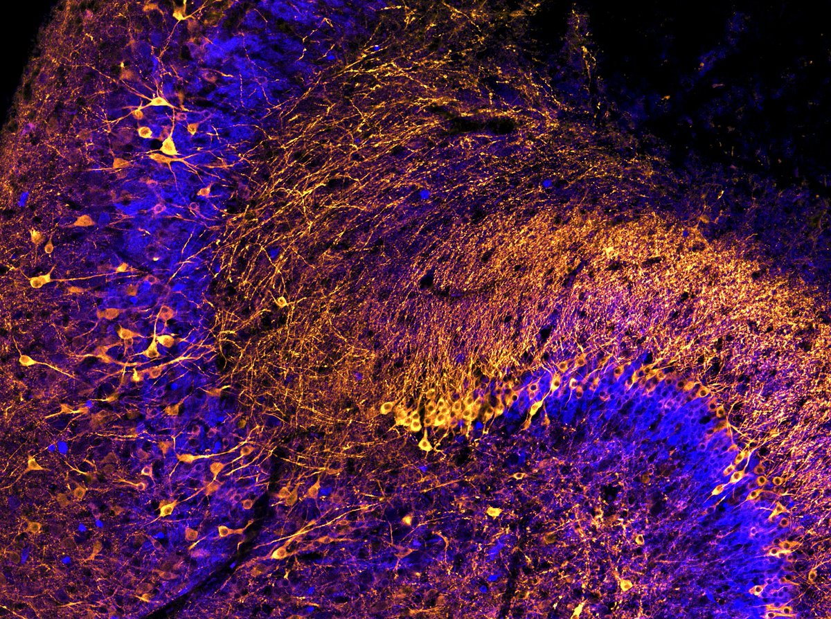 Neurogenesis in action: the balance between newborn neurons (doublecortin, blue) and mature neurons (map2, gold) is such an amazing and unique process in the hippocampus!🧠🔬#fluorescencefriday <a href="/zeiss_micro/">ZEISS Microscopy</a> #neuroscience