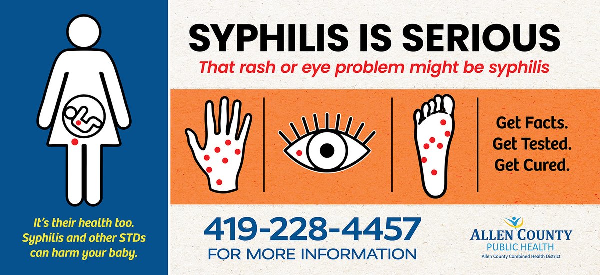 To learn more about the causes and symptoms of syphilis visit:
odh.ohio.gov/know-our-progr…

To learn about the resources available at Allen County Public Health visit: allencountypublichealth.org/.../std-clinic…

#freestdtest #STITesting #KnowYourStatusGetTested #ODH #STD #stdtesting #stdawareness