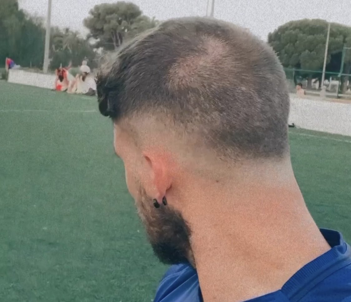 ¿Te parece normal que me hagan esto en la cabeza? Manden peluqueros a España 🇪🇸😭