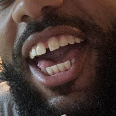 radio_raph's tweet image. #NewProfilePic