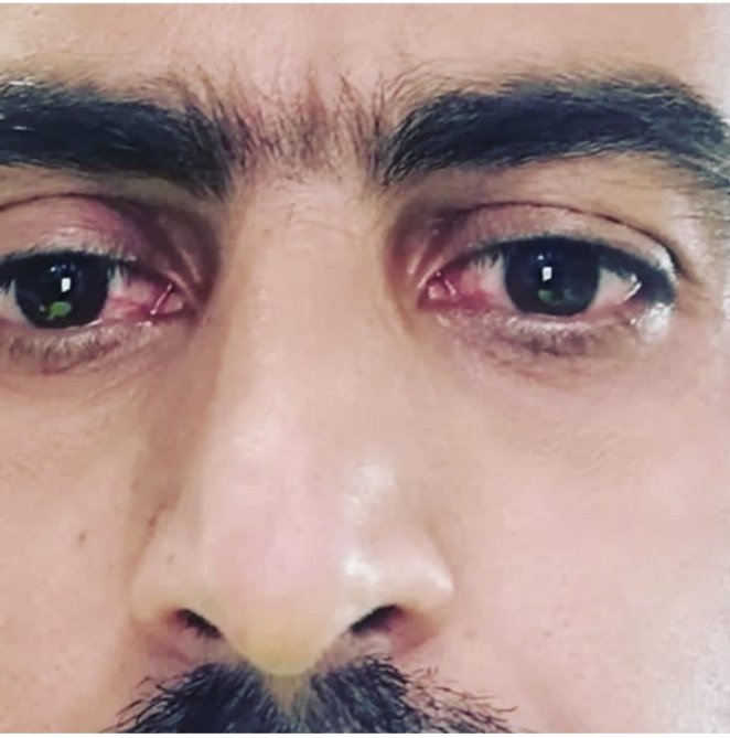 hunter king tweet media