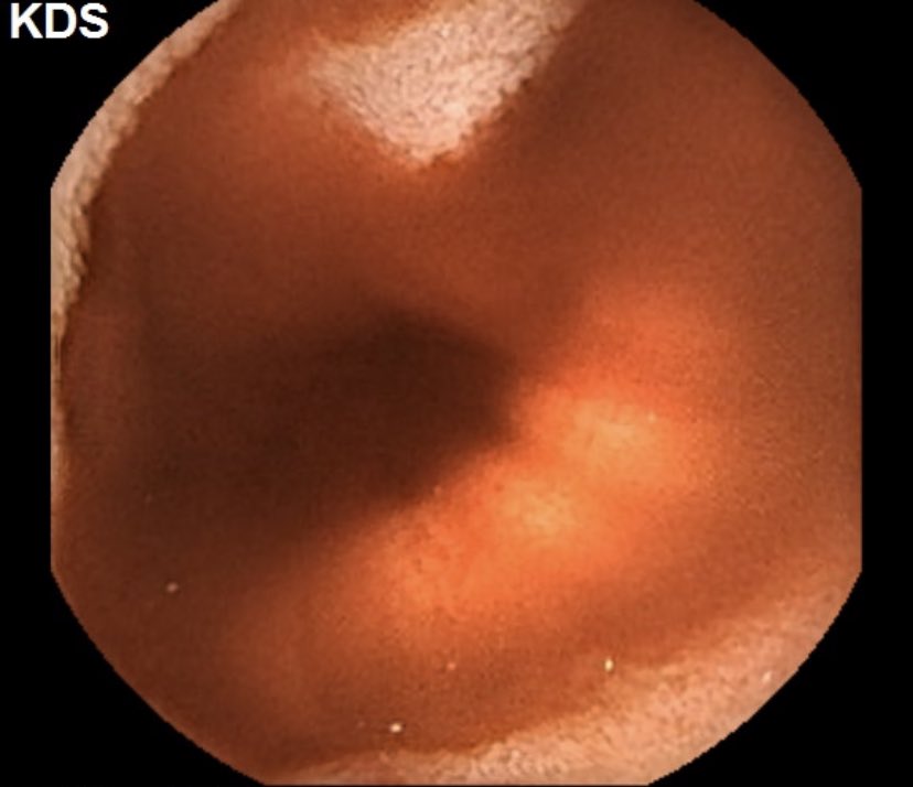 vinay dhir tweet media