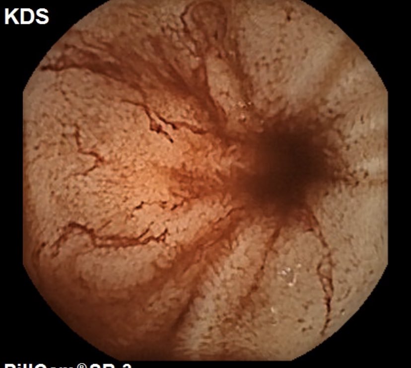 vinay dhir tweet media