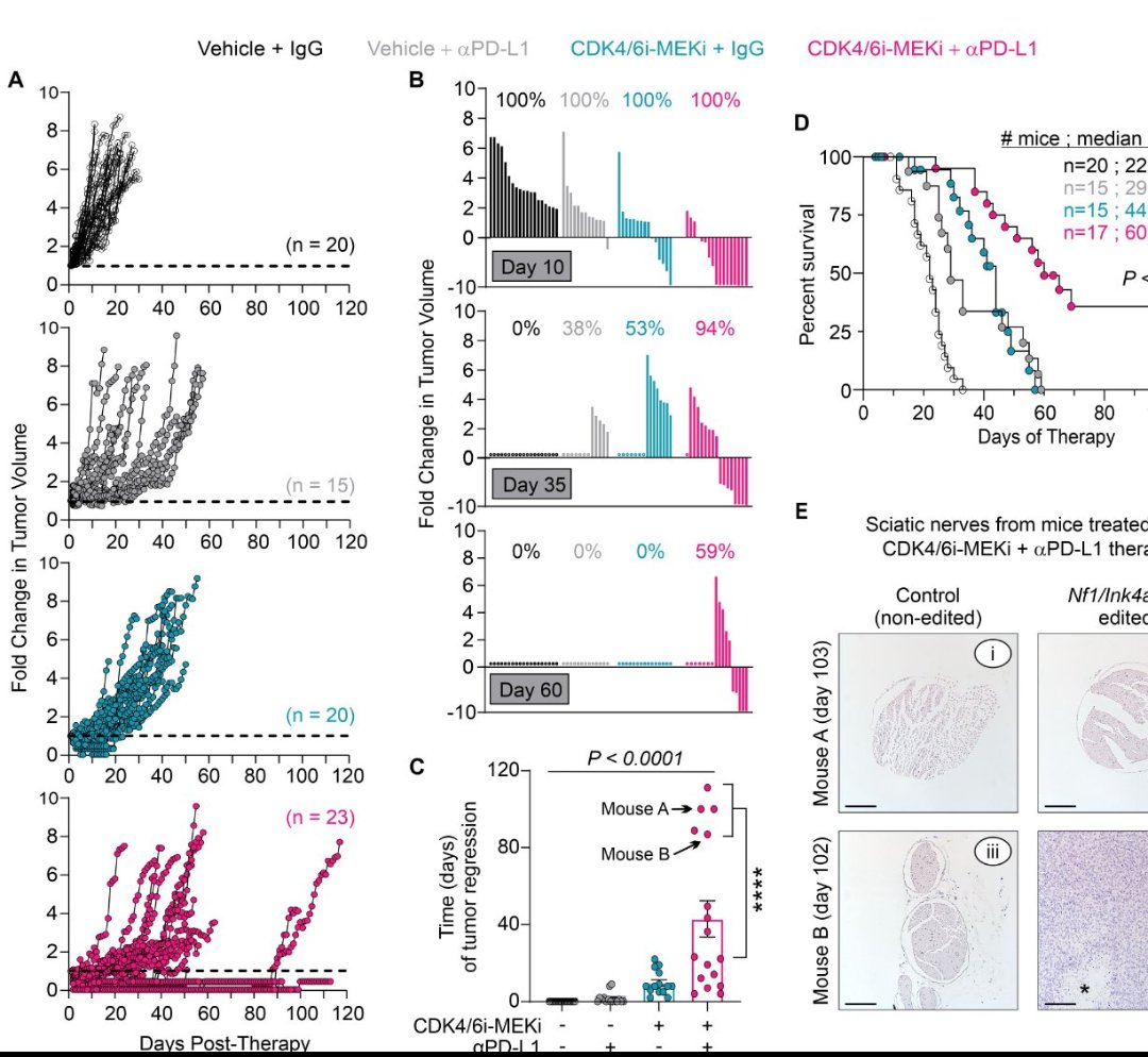 CrozrX's tweet photo. Preclinical findings provide strong rationale for clinical translation of CDK4/6▪︎MEK▪︎ICB 🎯 therapies in #MPNST as they may yield sustained antitumor responses and improved patient outcomes.
@LingointheLab https://t.co/TN5ToHvhqj