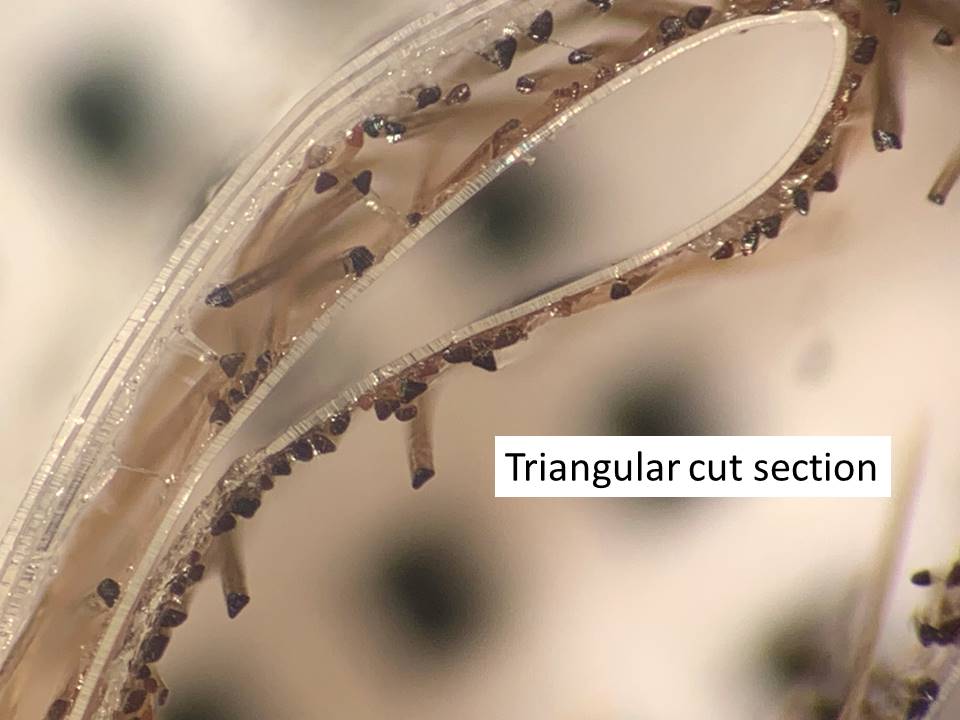 carles_saus's tweet photo. UNCOMBABLE HAIR SYNDROME (PILI  CANALICULI)
Rare. Autosomic dominant. Unruly hair difficult to style.
- Very subtle longitudinal grooves on light microscopy  
- Best seen in transversal sections using adhesive tape:
 - Triangle  shaped hairs

#dermtwitter #pathology #PathTwitter https://t.co/RrjalxhXqe