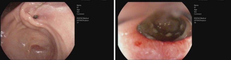 Derby Pancreaticobiliary & Robotic AWR Unit tweet media