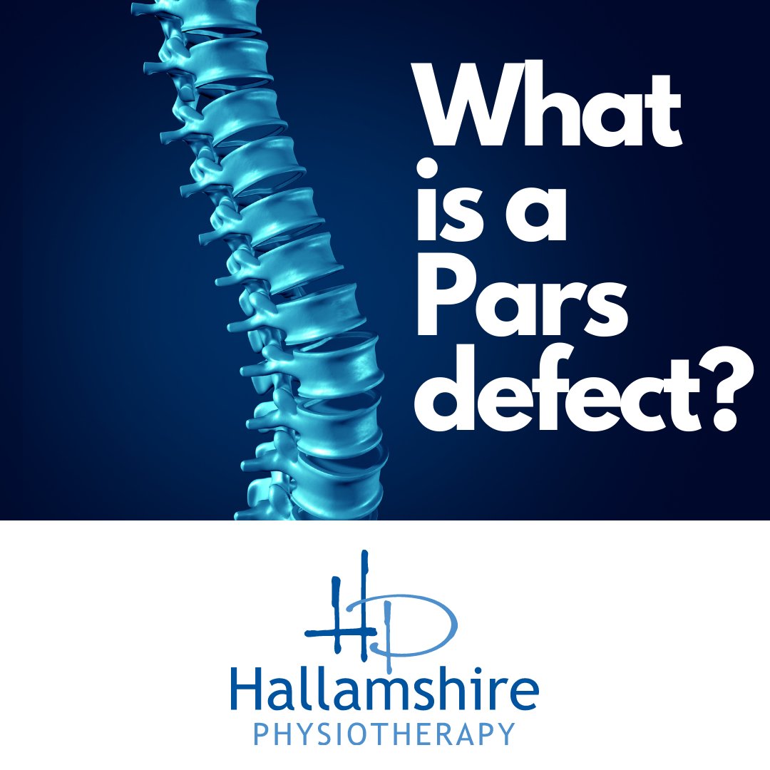 sheffieldphysio tweet media