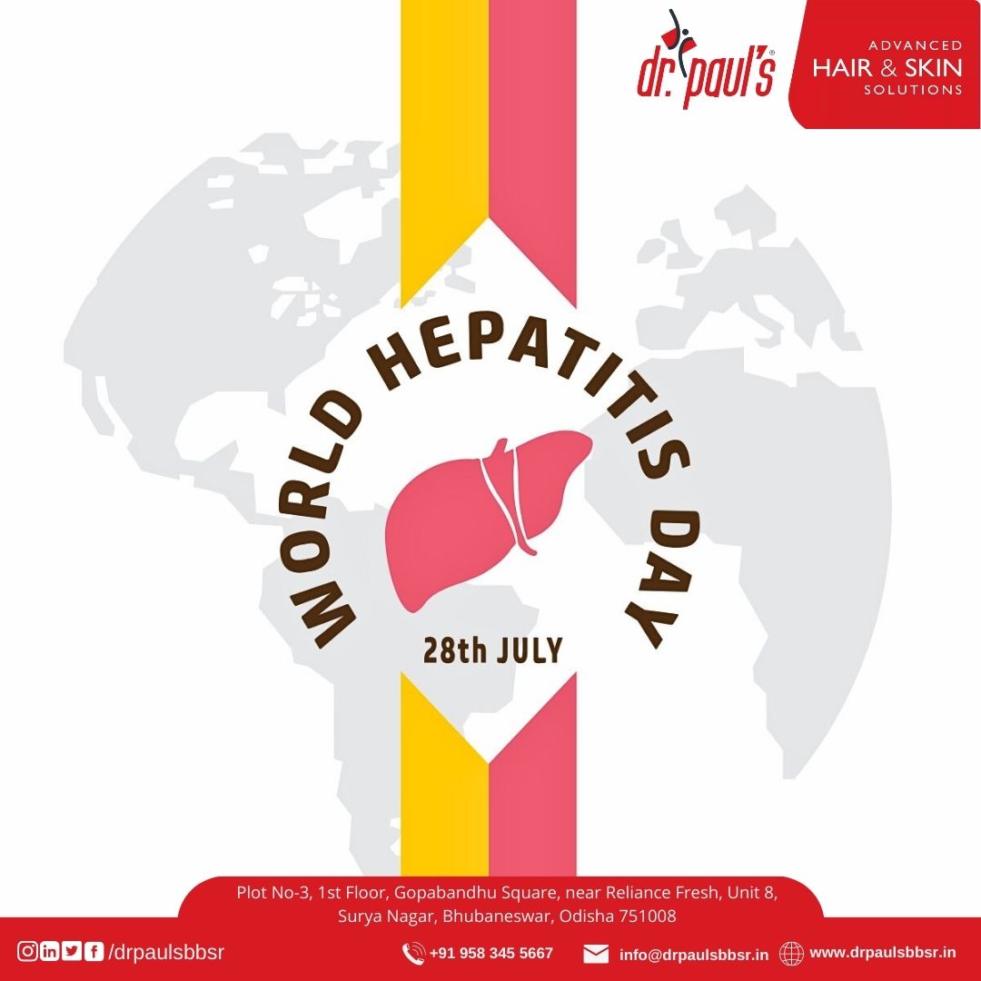 drpaulbbsr_'s tweet image. Hepatitis affects millions worldwide, but it&apos;s preventable! Join on World Hepatitis Day to learn how to protect yourself and your community.
#PreventionIsKey #WorldHepatitisDay #HepatitisPreventable #HepatitisSupportGroup #drpaul