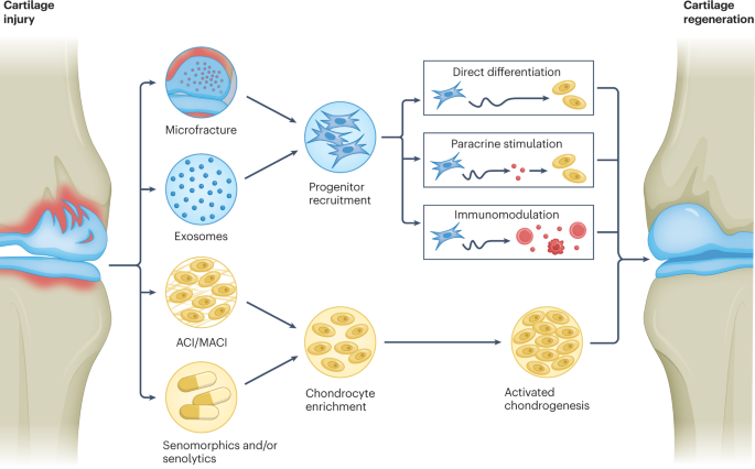 Why does #cartilage fail to spontaneously regenerate? This review connects the battle of hypotheses with current or envisioned therapeutic strategies, including cellular, genetic, mechanical and pharmacological treatments: doi.org/10.1038/s41584… <a href="/sathishmuthudr/">Sathish Muthu</a> <a href="/JVKorpershoek/">Jasmijn Korpershoek</a>