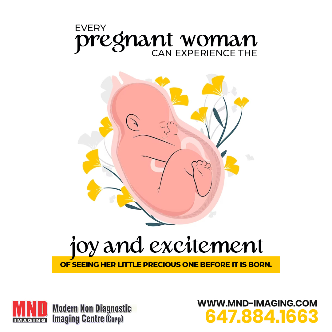 mndimaging's tweet photo. Book your appointment : 647-884-1663
Website: https://t.co/FvY5Bw0cGK
#Ultrasound #UltrasoundClinic #BabyGenderTest #UltrasoundinBrampton #Sonography #BabyGenderTesting #DiagnosticImagingCenter #Brampton #Ontario #Canada #UltrasoundBabyGenderTesting https://t.co/1oW7NU3TLN