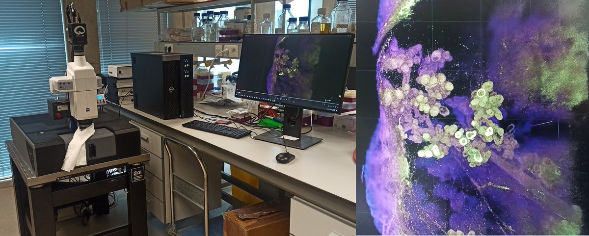 Intravital Imaging Expertise Center (@_intravital) on Twitter photo Lightsheet week ☑ Thanks heaps for a wonderful demo <a href="/3i_inc/">3i</a>! It was truly stunning. Beautiful TDLUs and more <a href="/ColindaScheele/">Colinda Scheele</a> <a href="/larissamourao_/">Larissa Mourão</a> #FluorescenceFriday #Lightsheetmicroscopy Lightsheet week ☑ Thanks heaps for a wonderful demo <a href="/3i_inc/">3i</a>! It was truly stunning. Beautiful TDLUs and more <a href="/ColindaScheele/">Colinda Scheele</a> <a href="/larissamourao_/">Larissa Mourão</a> #FluorescenceFriday #Lightsheetmicroscopy