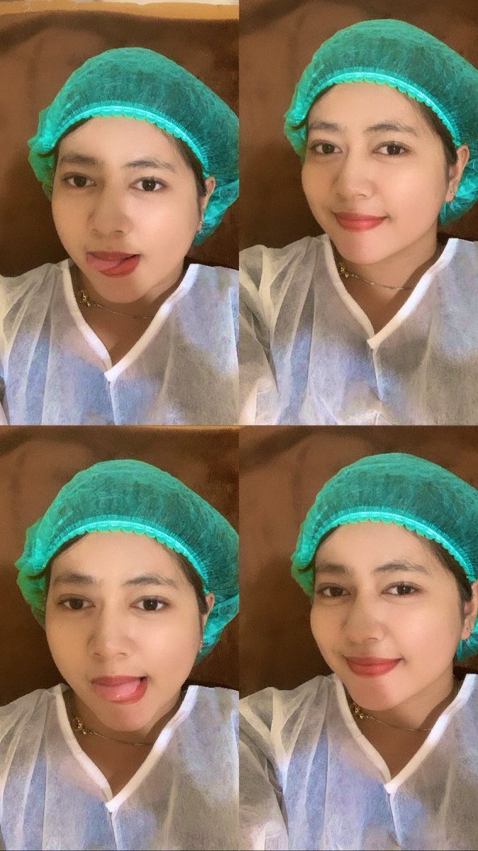mitaazhrr's tweet photo. Hawu! Aku baru aja ngelakuin treatment messo pipi (ngancurin lemak pipi)! Rasanya sakit dan sempet bengkak juga🥲🥲
Emang beauty is pain yaaa ~ https://t.co/opIFHZGc8E