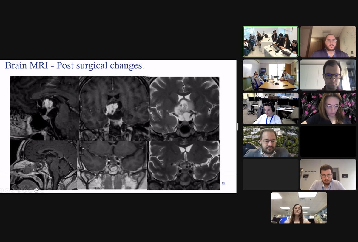 Loizos Michaelides, MD (@lmichmd) on Twitter photo Beautiful cases presented right now at at the Mayo Clinic Florida Case Records conference, by our colleagues from Fundacion Santa Fe de Bogota University Hospital from Colombia! <a href="/DoctorQMd/">Dr. Alfredo Quiñones-Hinojosa</a> <a href="/joao_p_almeida/">Joao Paulo Almeida</a> <a href="/MayoClinic/">Mayo Clinic</a> <a href="/MayoClinicNeuro/">Mayo Clinic Neuro</a> <a href="/mayoflnsgyres/">Mayo Clinic Florida Neurosurgery Residency</a> Beautiful cases presented right now at at the Mayo Clinic Florida Case Records conference, by our colleagues from Fundacion Santa Fe de Bogota University Hospital from Colombia! <a href="/DoctorQMd/">Dr. Alfredo Quiñones-Hinojosa</a> <a href="/joao_p_almeida/">Joao Paulo Almeida</a> <a href="/MayoClinic/">Mayo Clinic</a> <a href="/MayoClinicNeuro/">Mayo Clinic Neuro</a> <a href="/mayoflnsgyres/">Mayo Clinic Florida Neurosurgery Residency</a>
