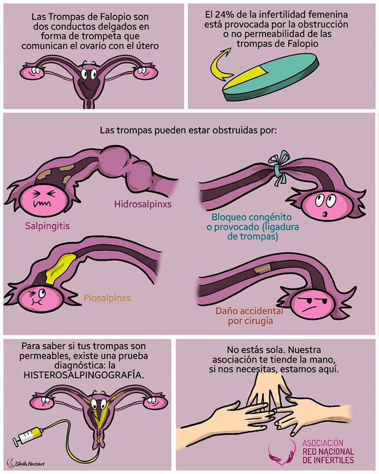 Causas que provocan infertilidad. Trompas de falopio obstruidas

La infertilidad es una enfermedad y son múltiples los motivos que la provocan. 

¿Nos ayudas a difundir y dar a conocerla?

¡Comparte y ayuda a poner voz a la infertilidad! 💚

#infertilpandy
