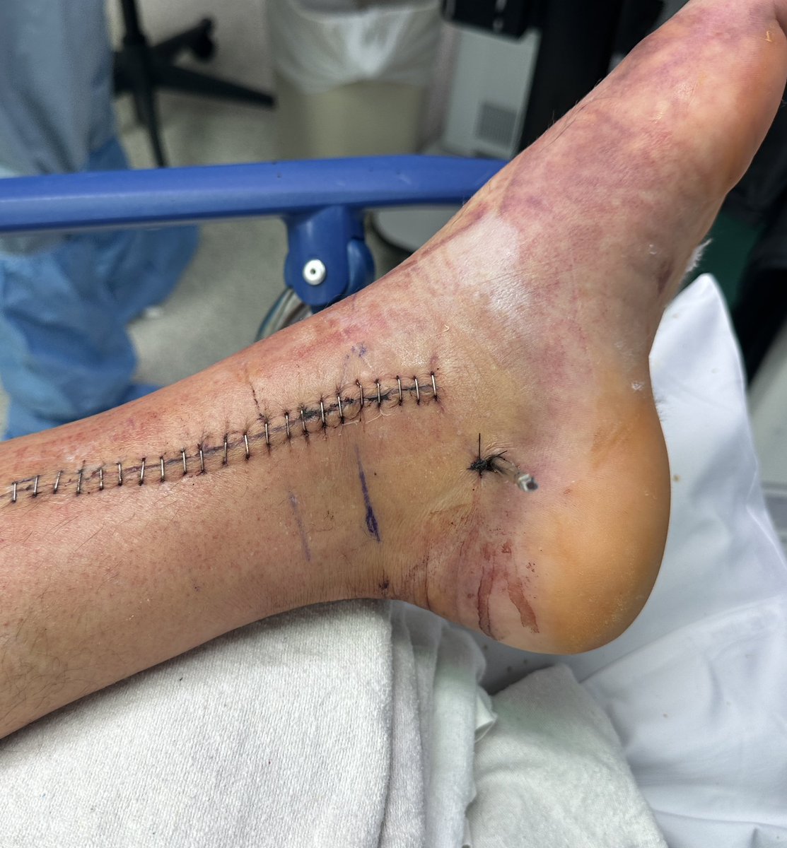 FootAndAnkleMD tweet media