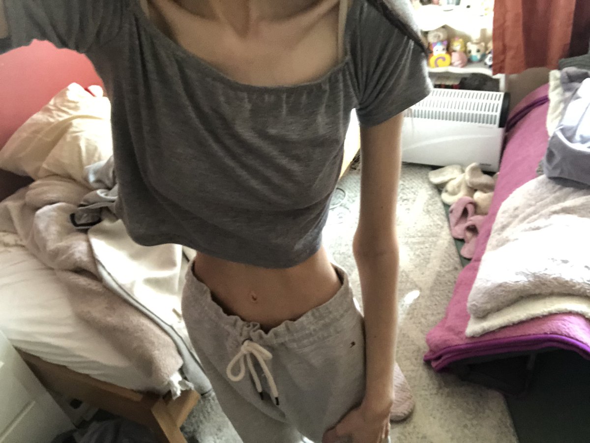 cinnamius's tweet image. bmi 20 ➡️ bmi 12 ➡️ bmi 14 ➡️ bmi 16