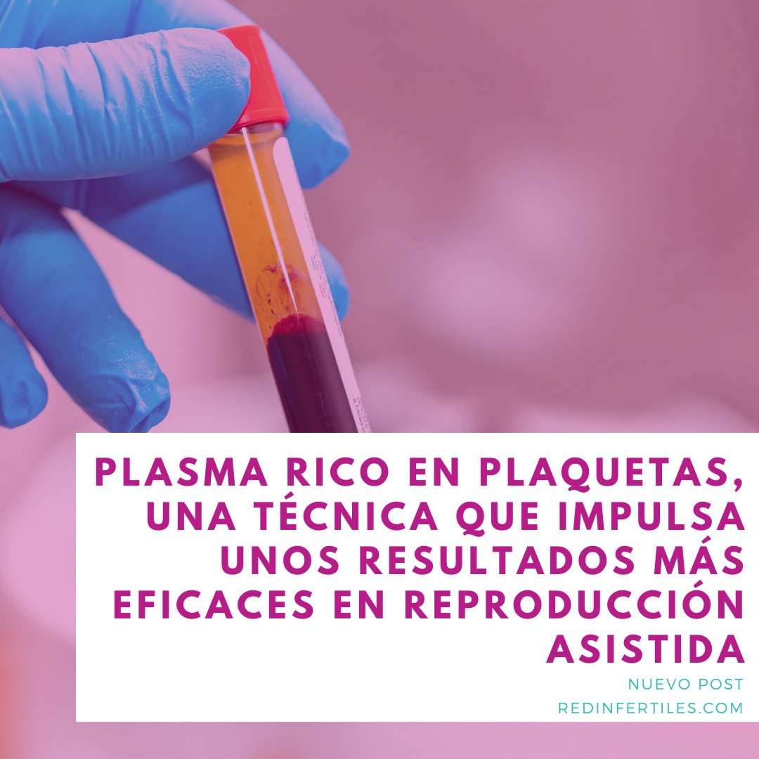 Plasma rico en plaquetas (PRP)

Si quieres saber con más detalle qué es el PRP, en qué consiste el tratamiento y cómo se aplica esta técnica ven a leer toda la información que hemos recopilado para ti de la mano de @EasyFIV 👉redinfertiles.com/plasma-rico-en…

#infertilpandy