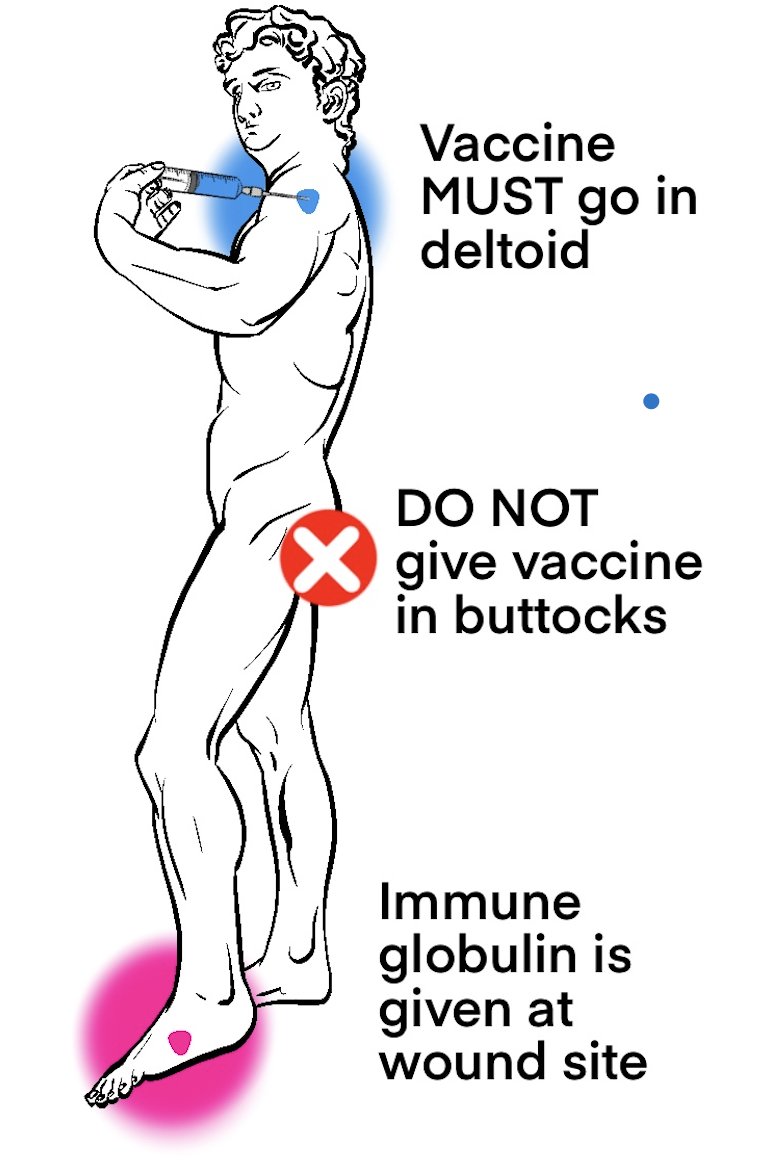 Tetanus (con't): Manage symptomatic tetanus w/ metronidazole to limit toxin production. To bind circulating toxin, administer tetanus toxoid vaccine (deltoid) and tetanus immune globulin (wound site). Provide respiratory support and manage muscle spasms w/ benzos

#MyEMCert