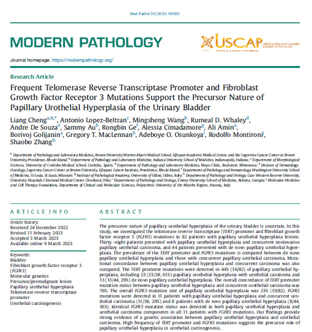 Liang Cheng, MD (@liangchengmd) on Twitter photo Just published in July issue of <a href="/ModernPathology/">Modern Pathology</a> (PMID 36906071)
- in search of elusive precursor of #bladdercancer
pubmed.ncbi.nlm.nih.gov/36906071/ Just published in July issue of <a href="/ModernPathology/">Modern Pathology</a> (PMID 36906071)
- in search of elusive precursor of #bladdercancer
pubmed.ncbi.nlm.nih.gov/36906071/