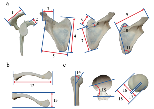 ASESmembers's tweet photo. Morphological characteristics of the shoulder girdle can provide insights regarding the presence of subacromial bone spurs. https://t.co/WUjIu6DZ7d
#ASESMembers #OrthoTwitter https://t.co/frY2aDEECR