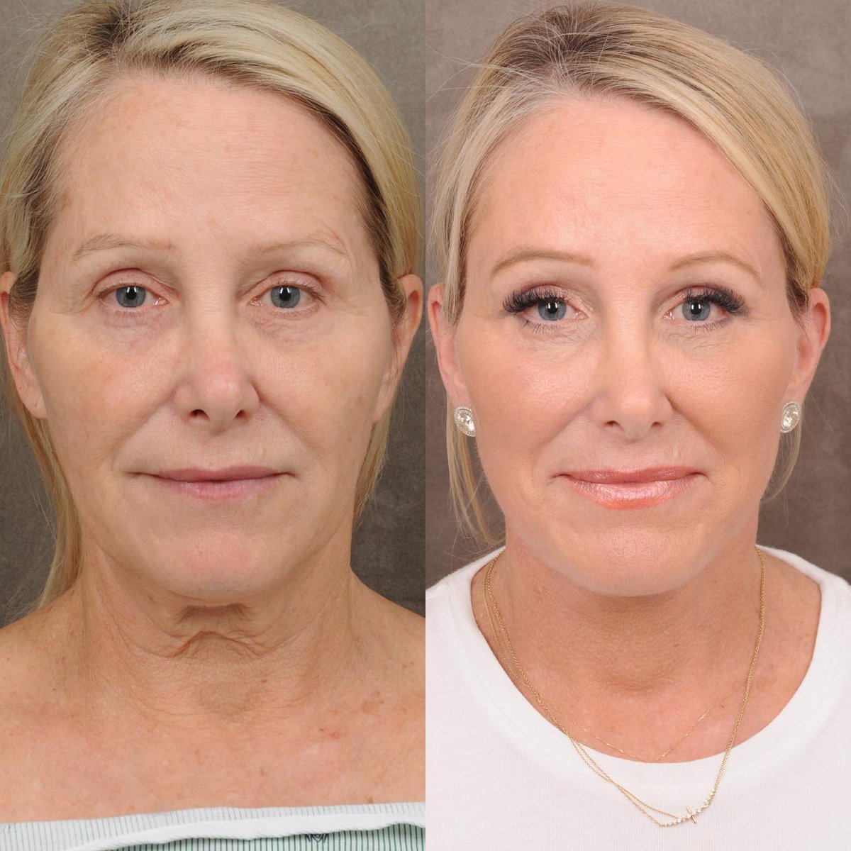 Dr. Ben Talei tweet media