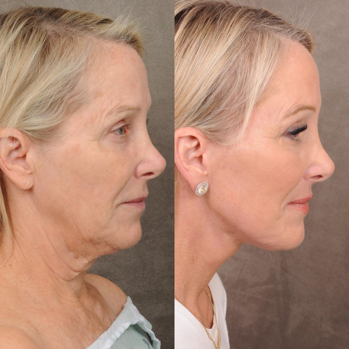 Dr. Ben Talei tweet media