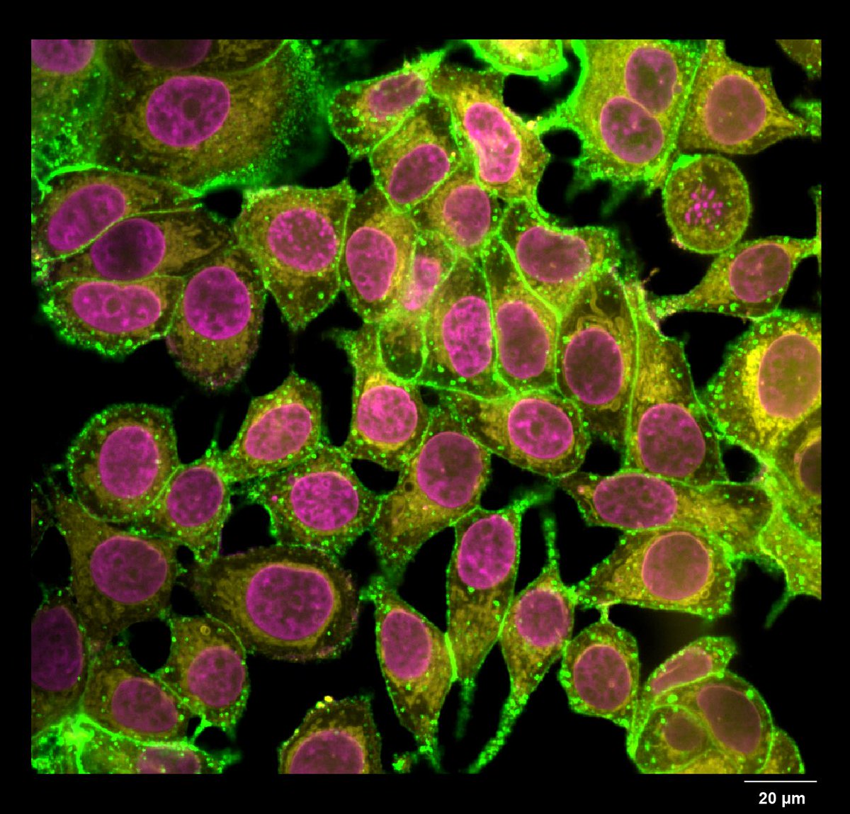 UMassIALS's tweet photo. Excellent entry for the #ialsimagecompetition from Jithu Krishna, graduate student from Chemistry, with PI Sankaran Thayumanavan!
#ialscbd #umasscorefacilities
Read more: https://t.co/8NC3UEX4sW https://t.co/T3xGh1ybfL