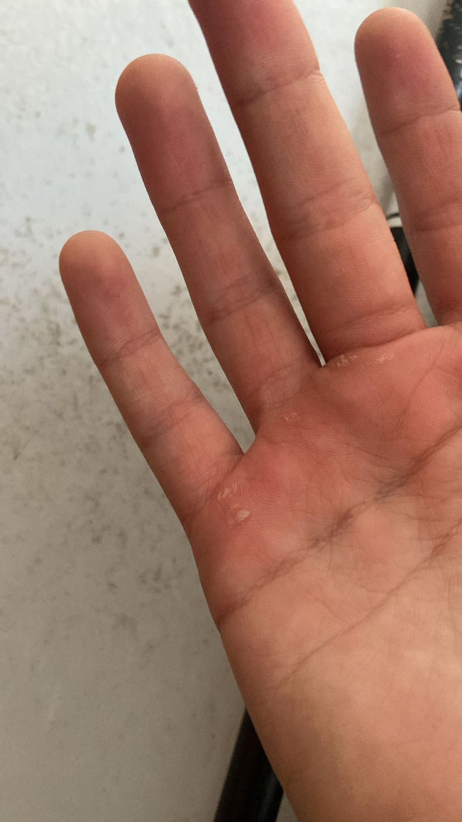 Dz jnr teaching himself drums. The hand is the result of Brianstorm by <a href="/ArcticMonkeys/">Arctic Monkeys</a>