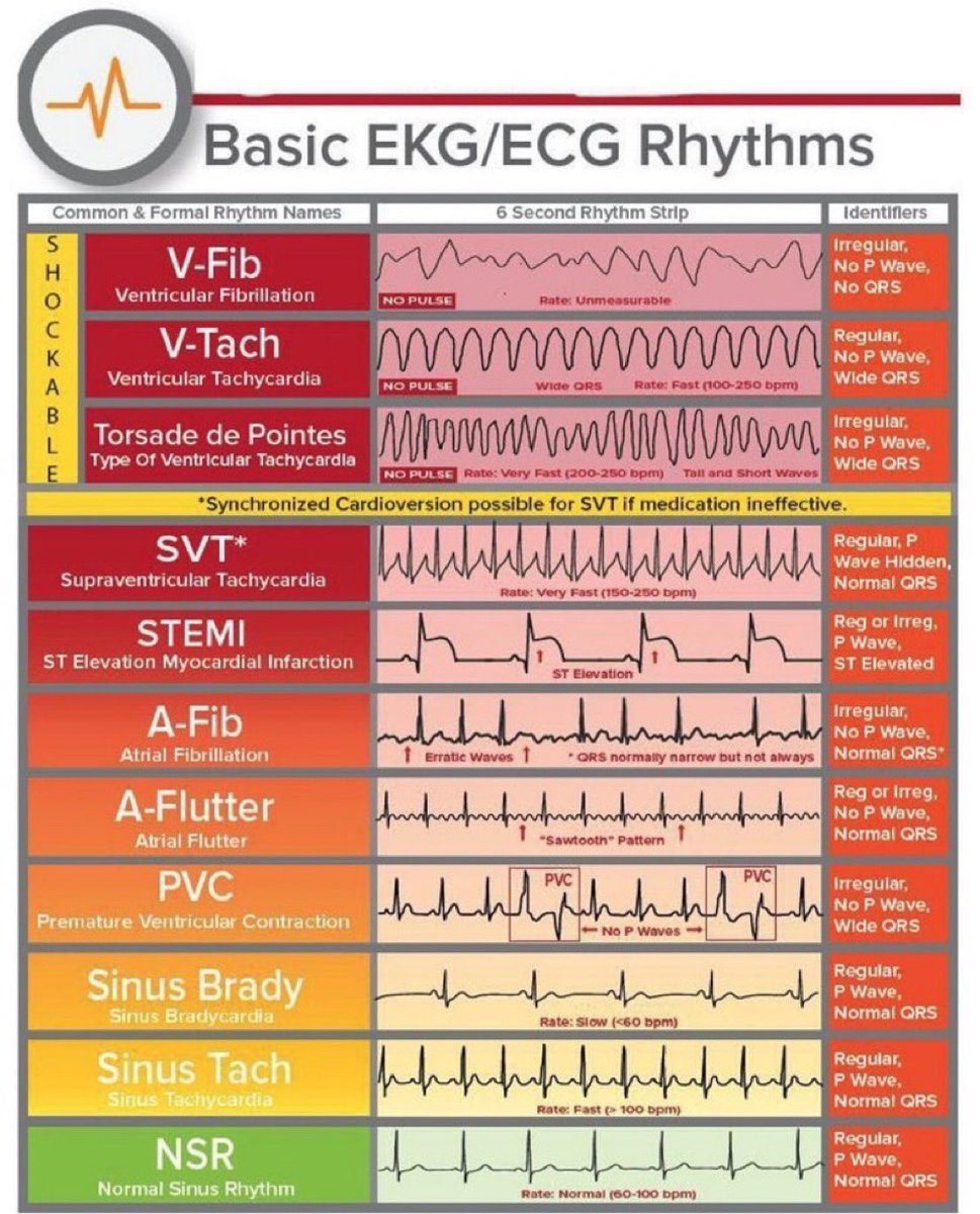 ResusMed's tweet photo. Basic Heart Rhythms https://t.co/O1BN0DoTDX