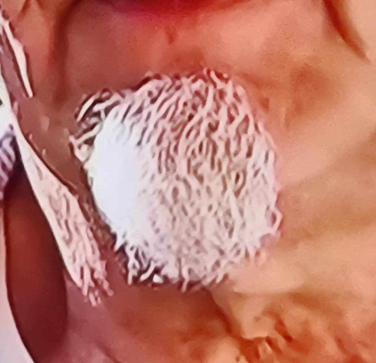 benvantoor's tweet photo. Al die vieze witte baardjes v die oude mannen 🤮. 

#benbvolliefde https://t.co/qWwydD5Hrp