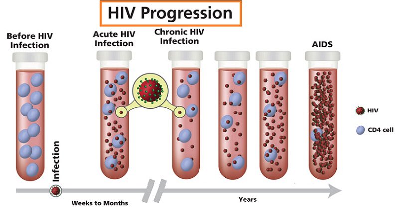 توضح الصورة الخلايا الليمفاوية التائية (CD4) قبل الإصابة بفيروس نقص المناعة المكتسبة ، وبعد الإصابة ، حيث ان الفيروس يبدا بتدمير هذه الخلايا. 
CD4 تساعد في منع العدوى عن طريق تحفيز جهاز المناعة للقضاء على البكتيريا والفيروسات ومسببات الأمراض الأخرى التي يحتمل أن تكون ضارة .